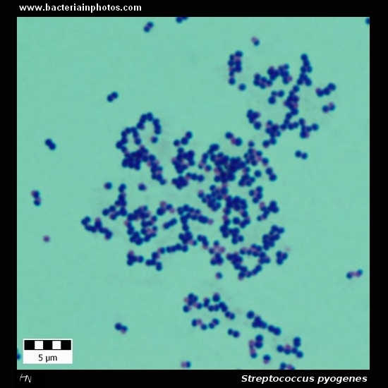 Streptococcus pyogenes   
                         microscopy, gram-positive cocci